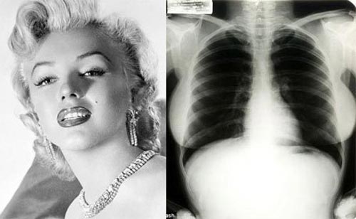 Такие снимки – подарок всем желающим узнать, что у звезд внутри