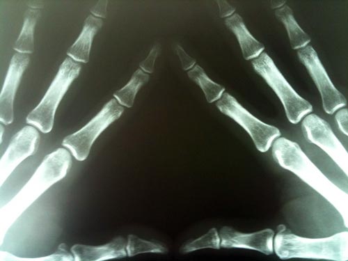 Жутковатый привет из рентгеновского аппарата. Michael Dorausch / Flickr.com