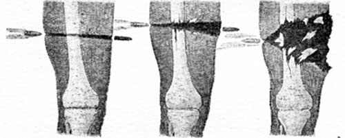 Принцип действия пули «дум-дум» при попадании в ногу противника. Рисунок: Upenn.edu