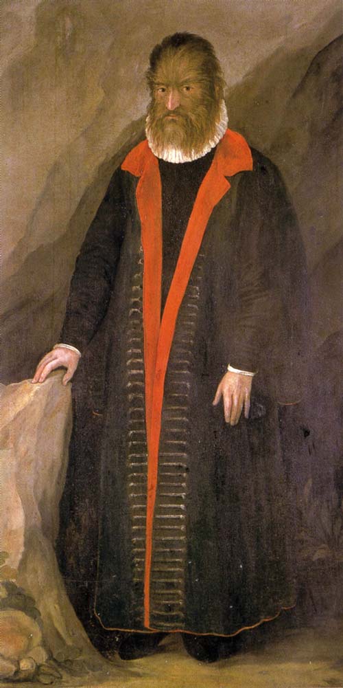 Портрет Педро Гонсалвуса. К сожалению для Педро, в июле 1559 года Генрих II погиб на рыцарском турнире, и регентшей стала Екатерина Медичи. wikipedia