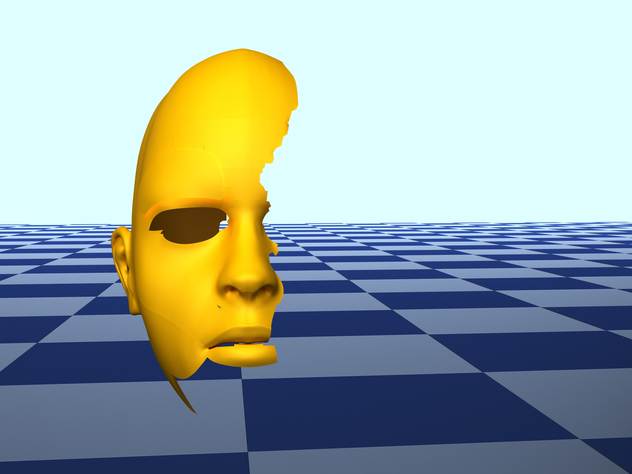 У Ника МакМэхона повреждена треть головного мозга, что вызвало необратимые изменения личности.