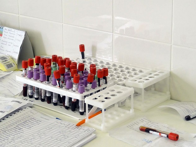 В Башкирии 220 беременных женщин оказались ВИЧ-инфицированными