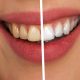 Восстановить зубную эмаль можно с помощью нового прочного материала