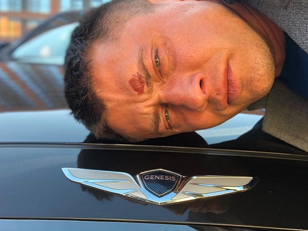 Звезда сериала «Мажор» попал в больницу