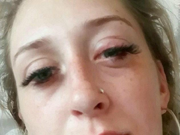 Медики смогли вернуть зрение жительнице Лондона