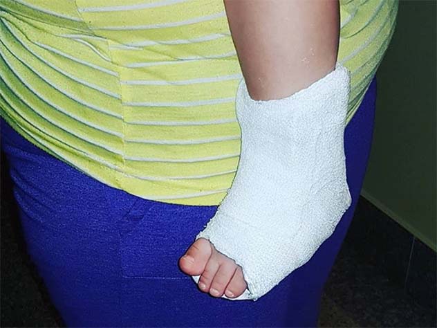 Актриса не стала рассказывать, как именно была получена травма