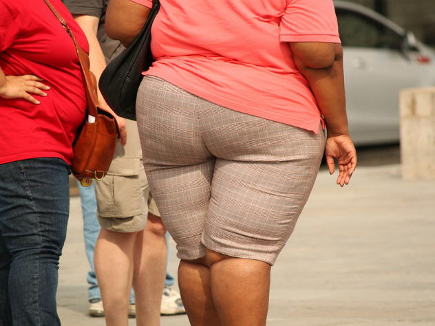 Ожирение, толстый, толстяк, женщина