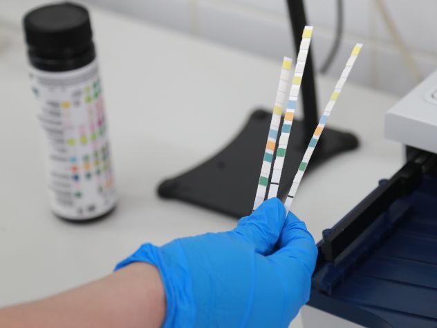 Ученые выяснили, что провоцирует рак кишечника