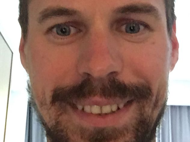 Устюгов в Италии сломал палец