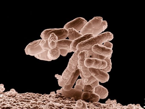 Кишечная палочка