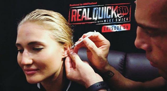 Врач убирает скопившуюся кровь при переломе ушной раковины, это вам не цацки. Фото: Instagram** / anastasia_yankova