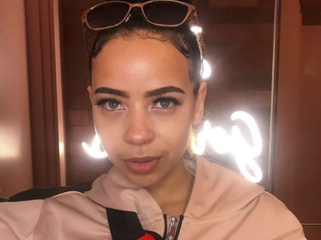 Веган из Британии лишилась волос