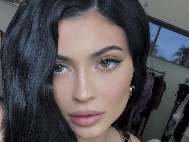 новый тренд в пластике губ