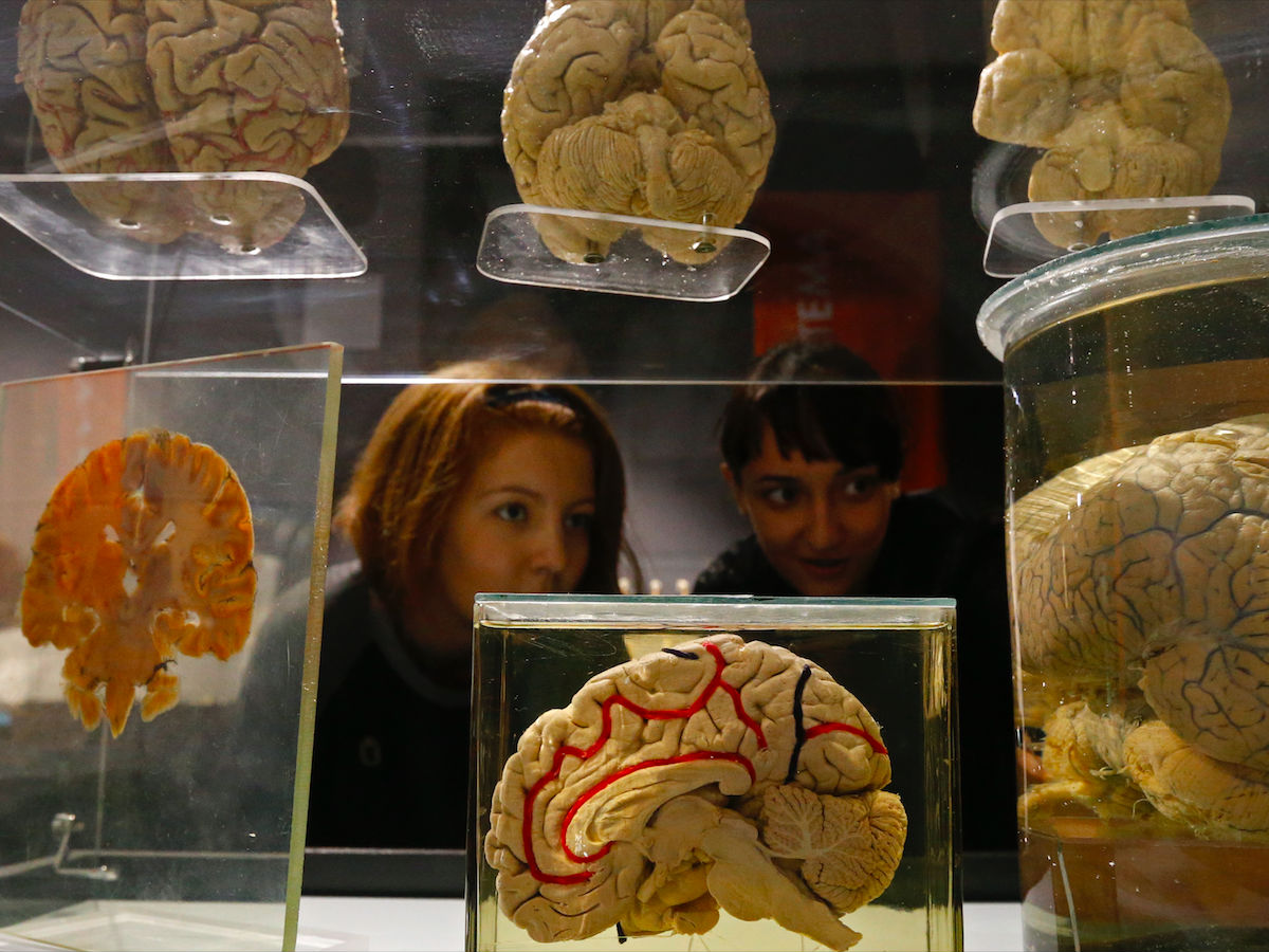 Мозг, череп, органы