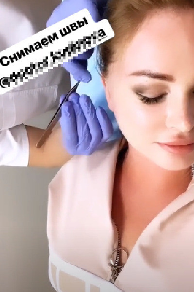 Дарья Пынзарь, пластика