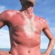 Солнечное тату — один из самых опасных трендов лета-2019
