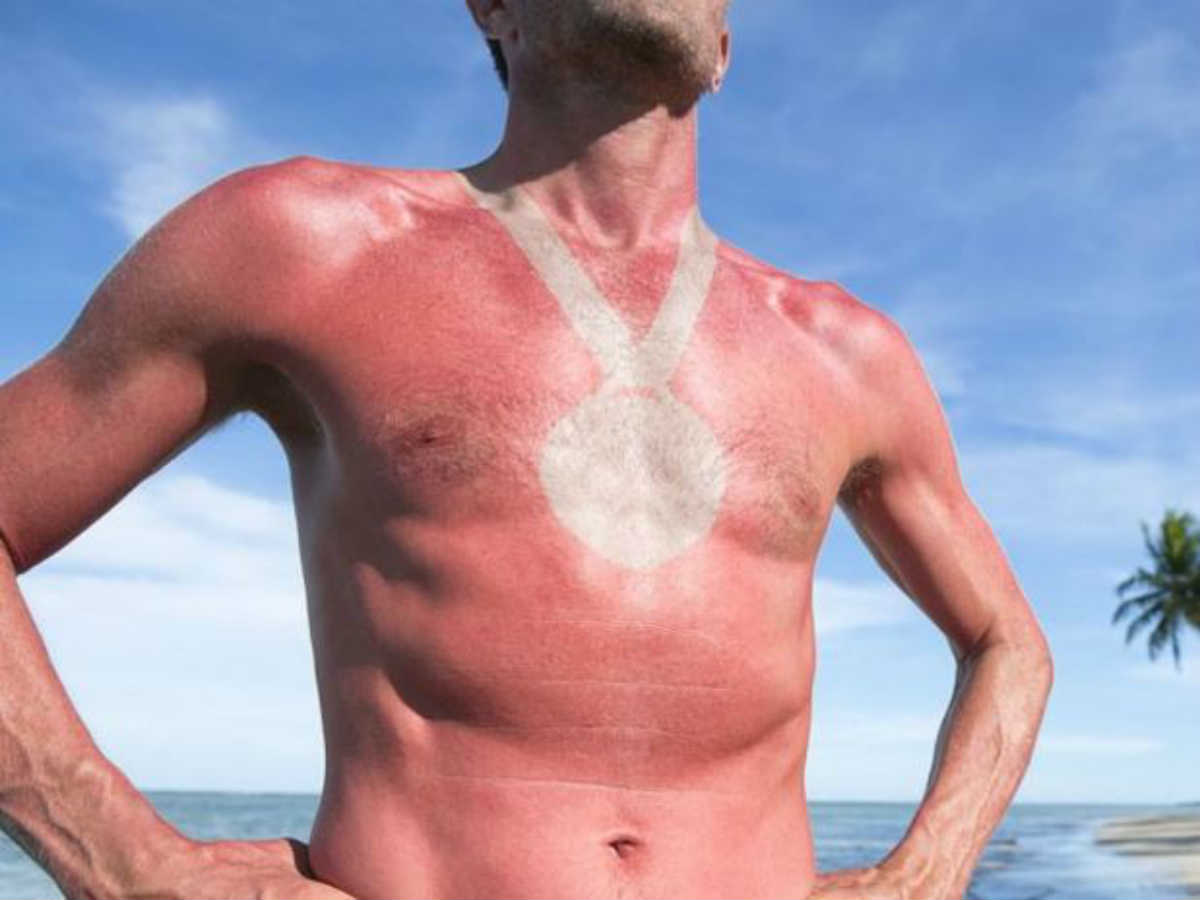 Солнечное тату — один из самых опасных трендов лета-2019