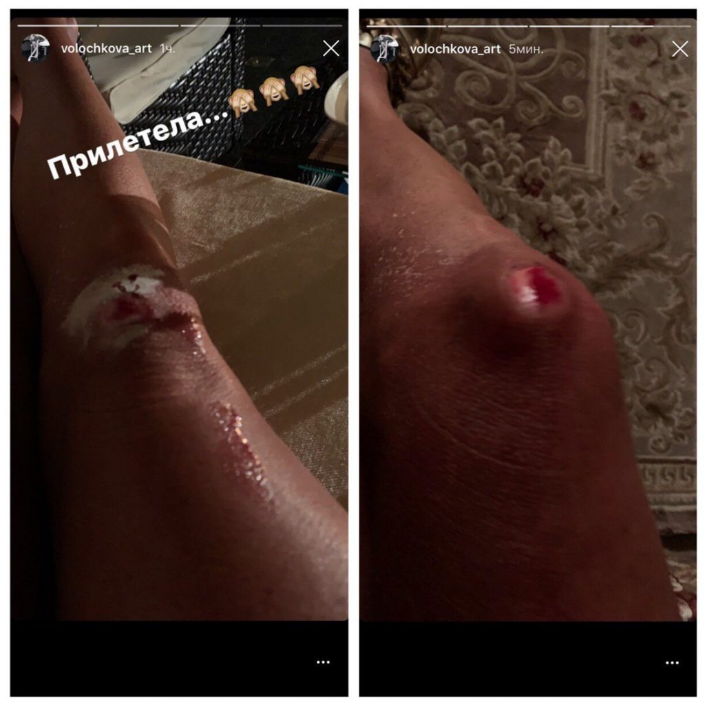 Сторис Анастасии Волочковой