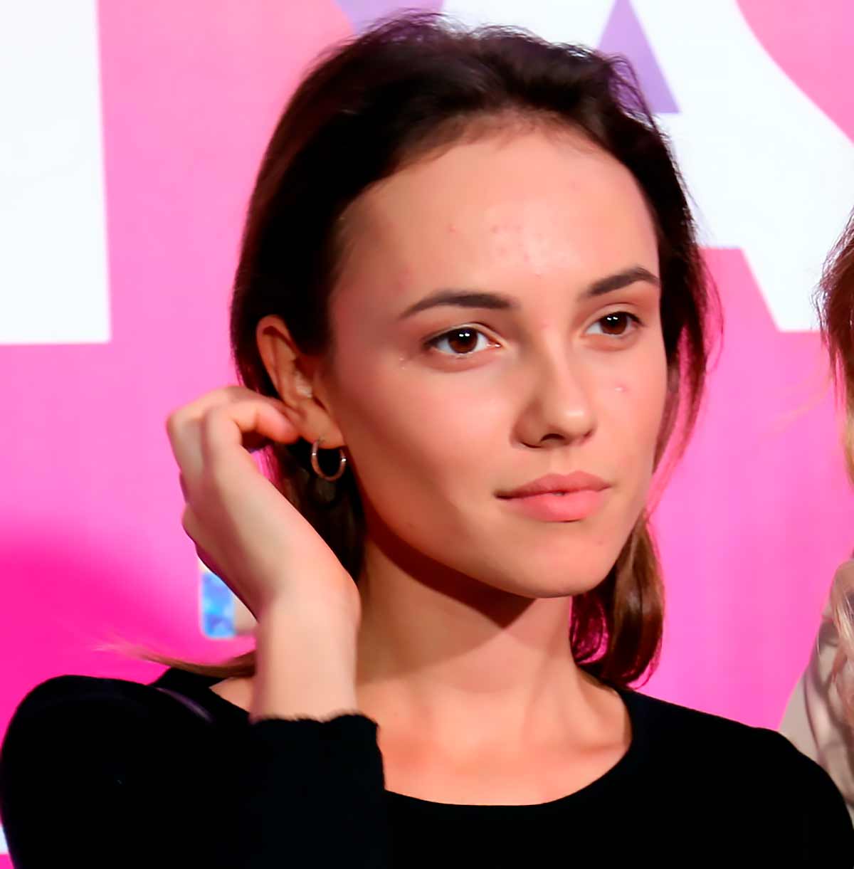 Милославской не мешало бы обратиться к врачу или косметологу