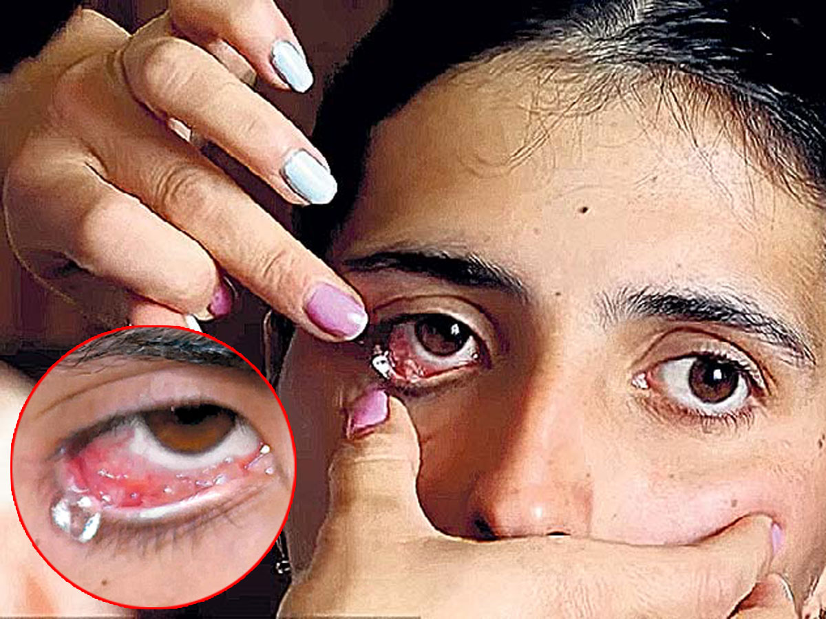 Поначалу врачи обвиняли Сатеник в том, что она сама засовывает стеклышки в глаза, чтобы привлечь внимание и заработать