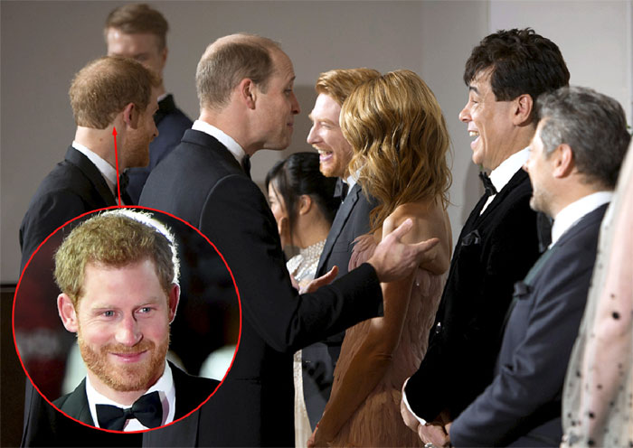 Принцы Гарри (слева) и Уильям давно сверкают голыми макушками, что доказывает: а) плешивость досталась им по линии мамы, а не от еще достаточно волосатого папаши; б) облезают они по-разному, что не исключает-таки участия конюха Джеймса Хьюитта в рождении младшего сына принцессы Дианы