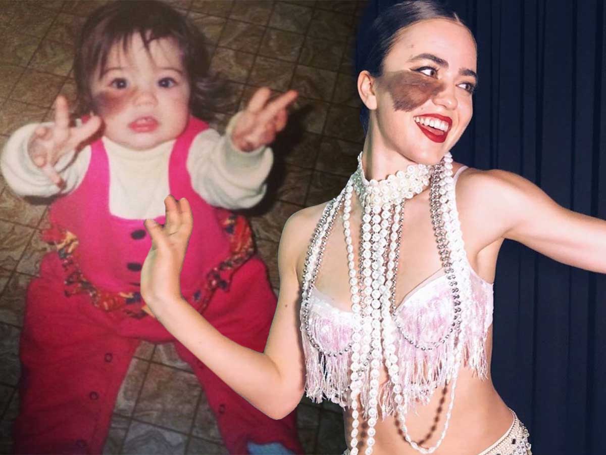 Дети с родимыми пятнами