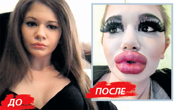 У 22-летней болгарки Ивановой теперь рот не закрывается, и питаться она может только жидким или пюреобразным
