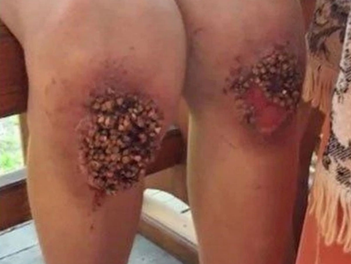 Мальчик на гречке