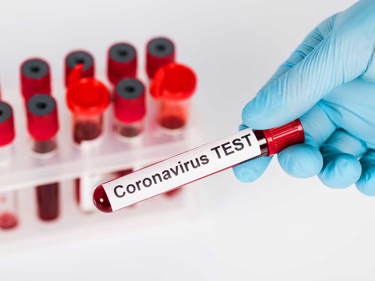 В России обнаружили еще шестерых заразившихся коронавирусом
