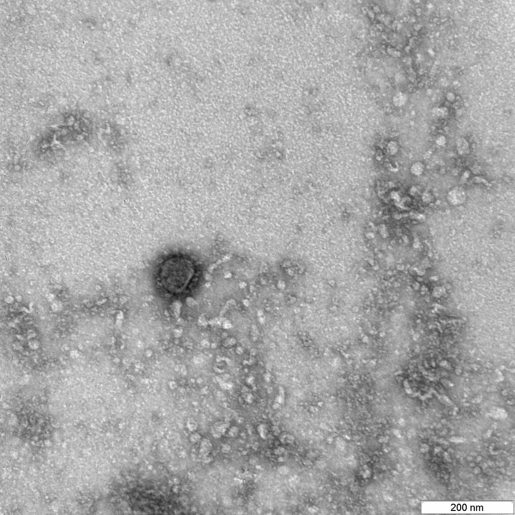 Вот так выглядит коронавирус под микроскопом
