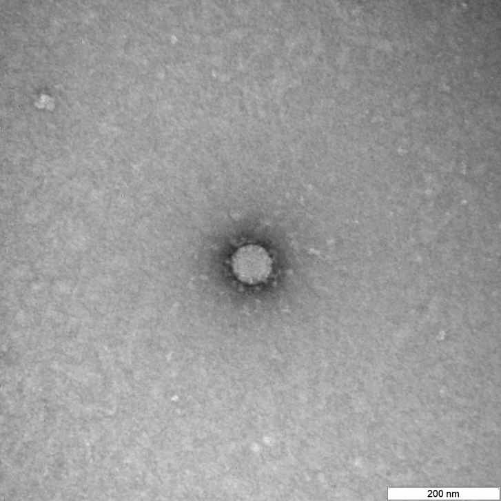 Российские ученые сфотографировали коронавирус