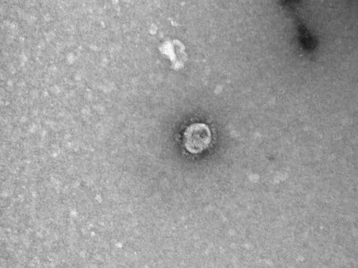 В Сети появились фото коронавируса, сделанные под микроскопом