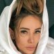 Айза Анохина сделала подтяжку лица