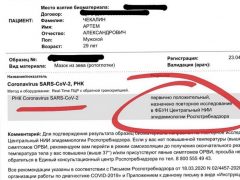 Результаты теста на коронавирус