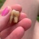 Вырванный зуб