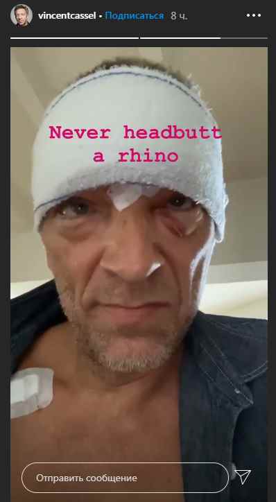 Венсан Кассель показал фото из больницы 