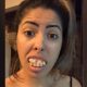 Блогер Жаклин Аларкао всех обманула страшными зубами