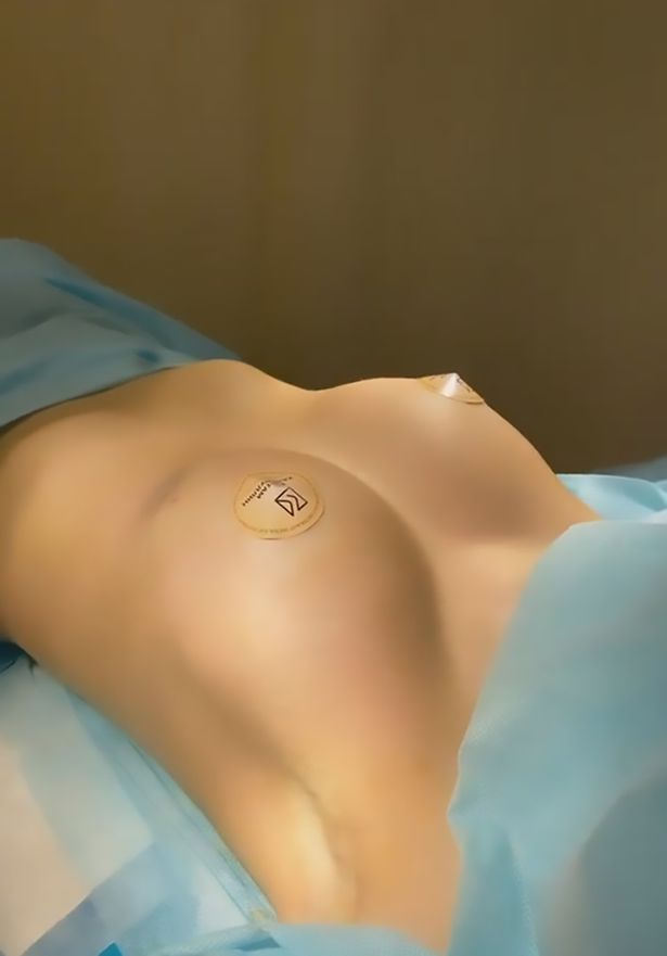 Увеличение груди Диденко