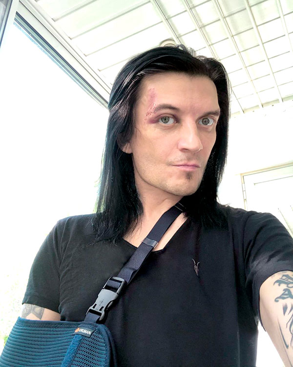 Дмитрий Хакимов