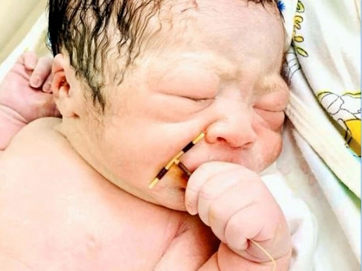 Словно в укор родителям, мальчонка вырвался из утробы матери на свет божий с противозачаточной спиралью в руке