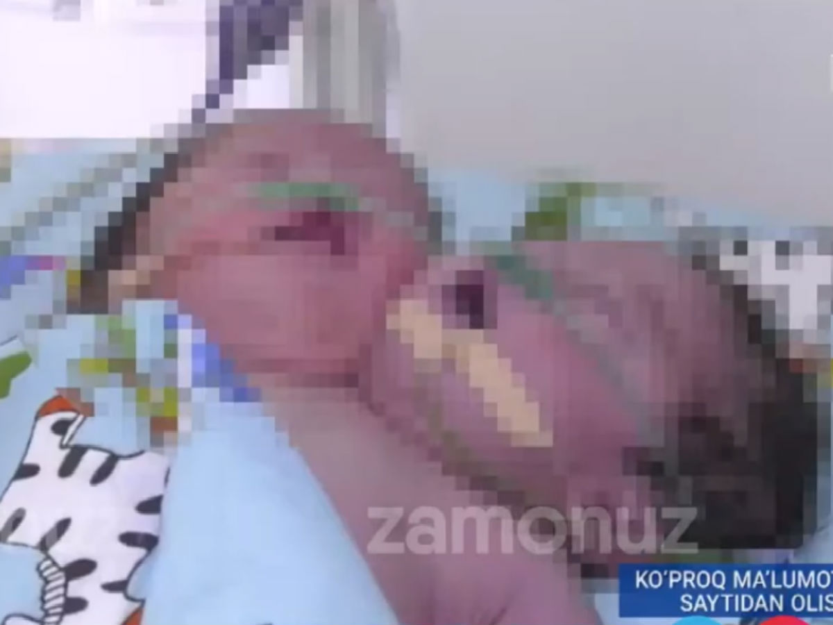 Двухголовый ребенок из Узбекистана