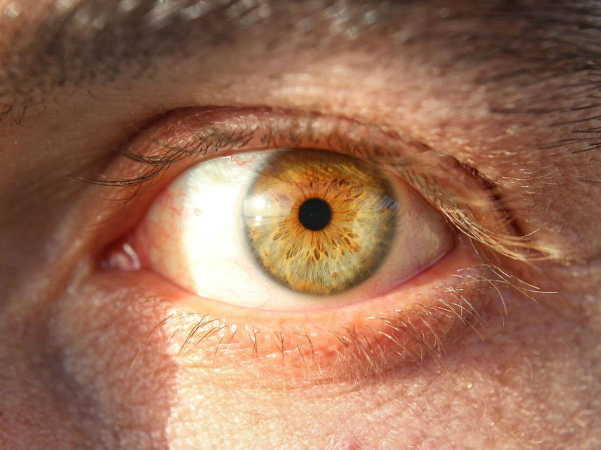 Размер зрачка указывает на скорую смерть