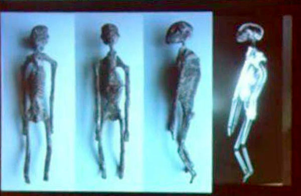 Рентгеновский снимок одной из найденных в Гизе мумий весьма озадачил археологов