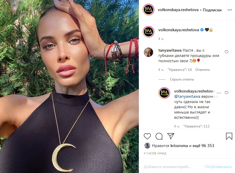 Анастасия Решетова рассказала правду о пластике губ