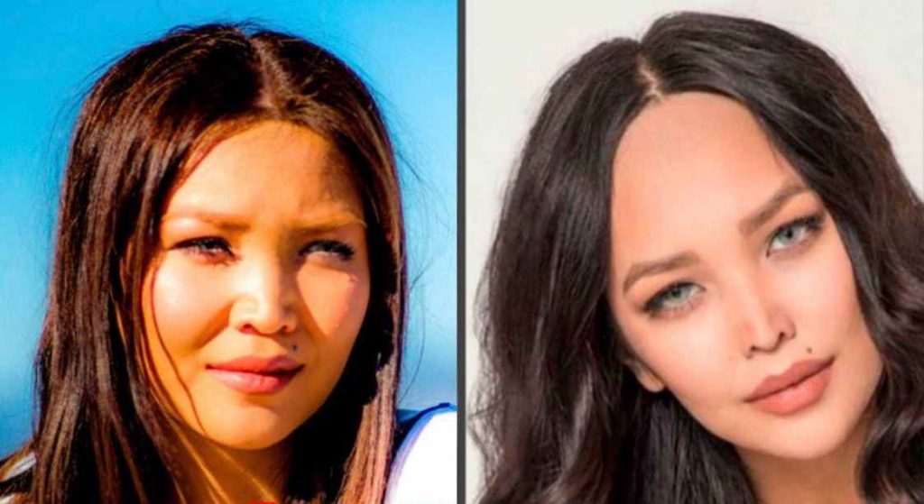 Вот так Дарина Эрвин выглядела до пластики