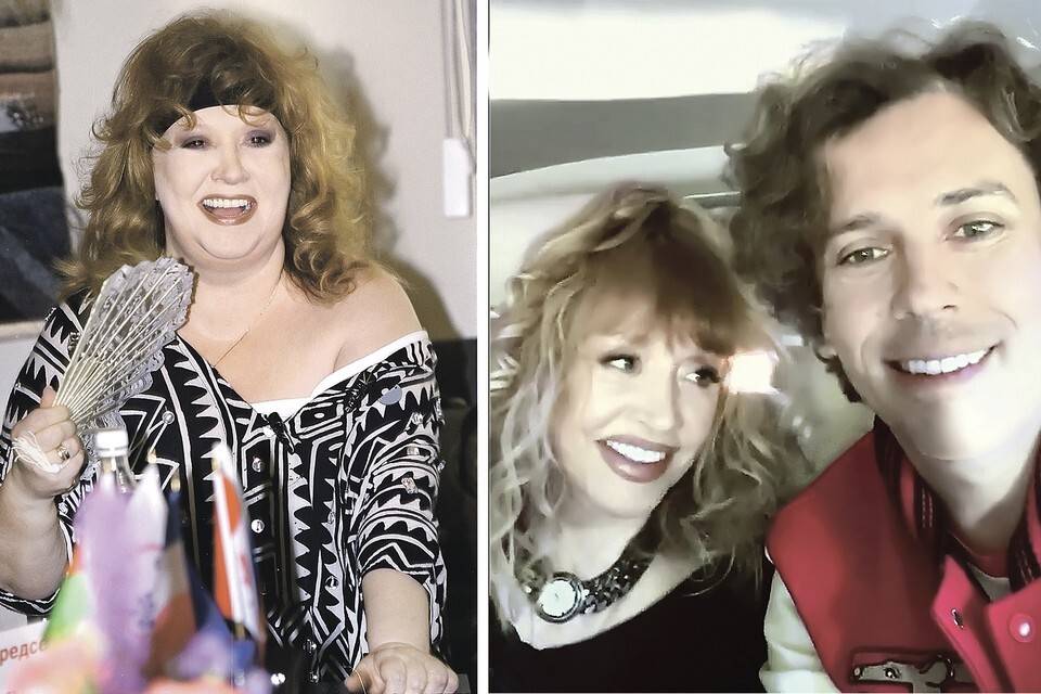 Алла Пугачева до и после пластики