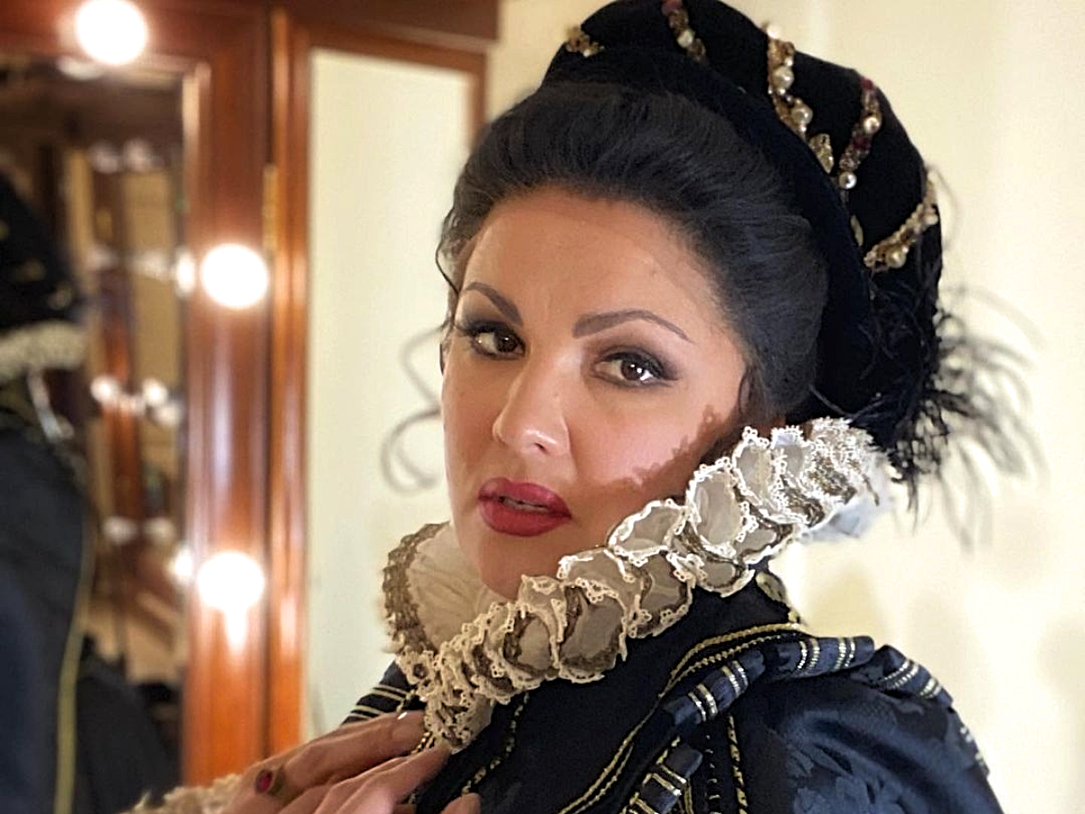 Анна Нетребко 