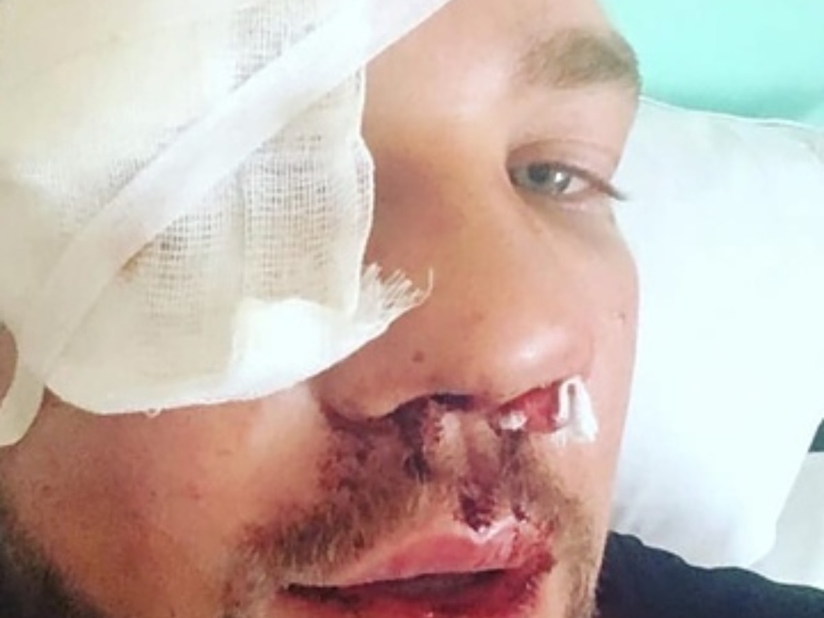 Избитый дагестанцами Роман Ковалев