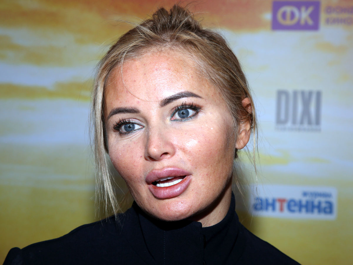 После откачки жира Дана Борисова прибавила 4,5 кило - Экспресс газета