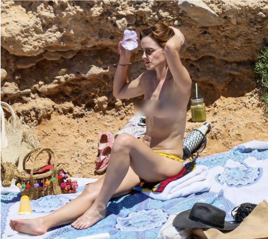 Измученную звезду «Гарри Поттера» сняли на пляже с голой грудью